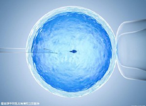 主案例